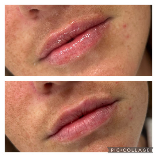 Noydeen Med Spa of Conway Arkansas