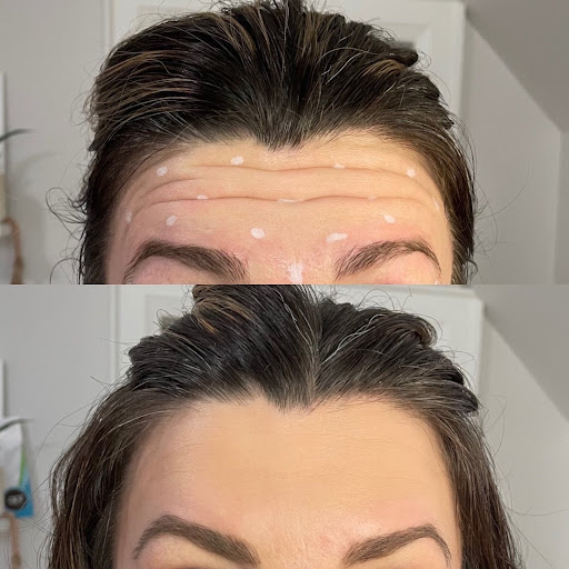 Injected by Bri - Thumbnail