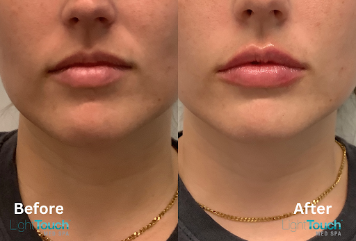 LightTouch Med Spa