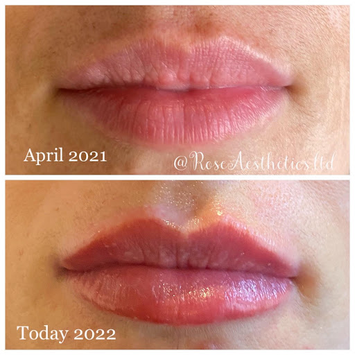 Rose Aesthetics Ltd - Thumbnail