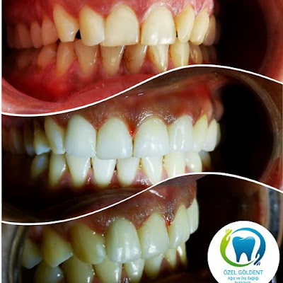Özel Göldent Ağız ve Diş Sağlığı Polikliniği