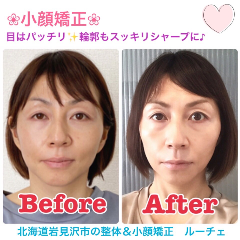 整体と小顔矯正サロンルーチェ 北海道岩見沢市元町 整体 グルコミ