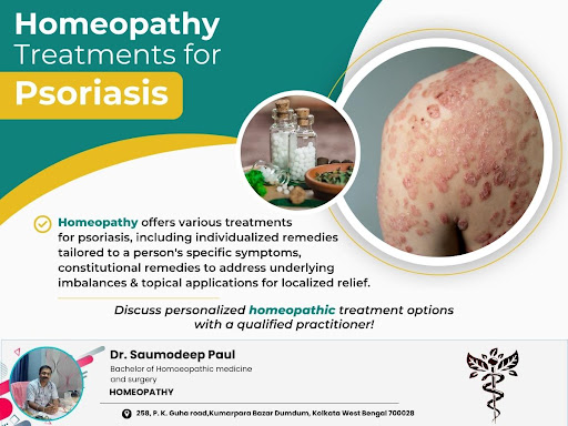Treatment of Psoriasis post image