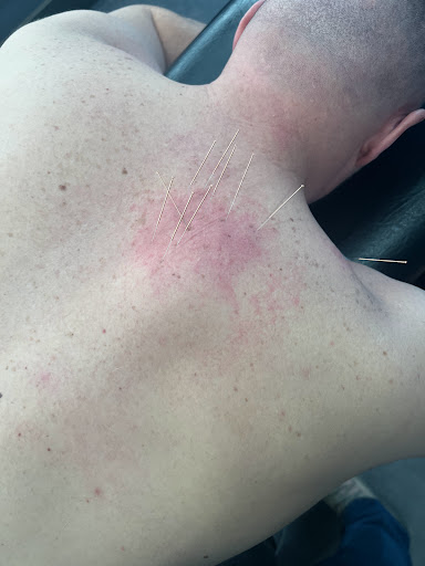 Primal Therapy Colindale Physiotherapy & Sports Injury Clinic - Thumbnail