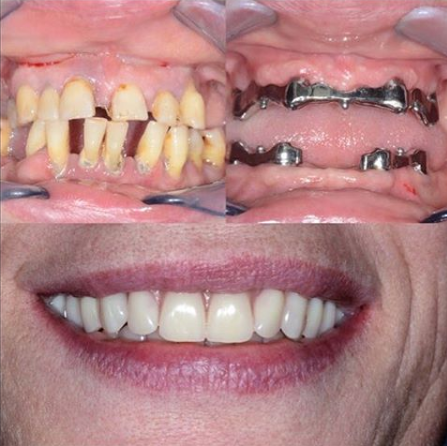 Studio Dentistico Bio Dental Core di Dr. Dario Tuscano - Thumbnail