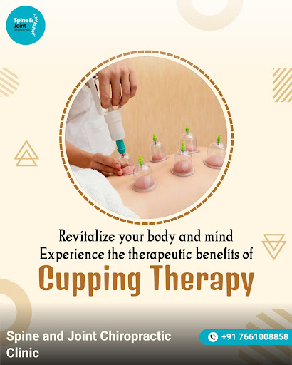 Experience Professional Cupping Therapy post image