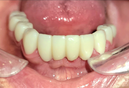 Long Falls Dentistry Gallery - United States