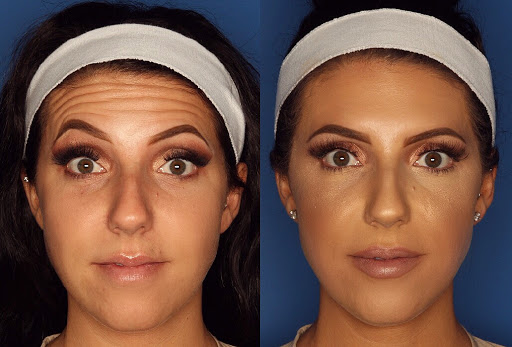 Laser Cliniqúe | San Diego's Premier Medical Spa