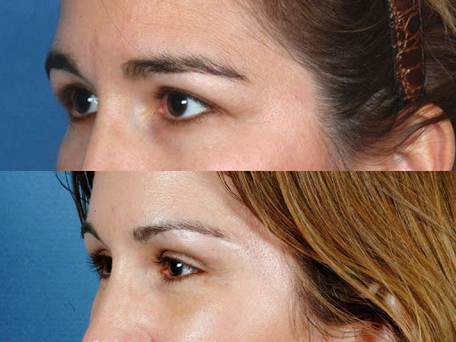 Rejuvenis Facial Cosmetic Surgery and Medical Spa