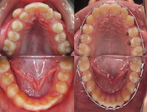 cabinet d'orthodontie (odf ) Dr Harmim Dr Zobiri, Author: cabinet d'orthodontie (odf ) Dr Harmim Dr Zobiri