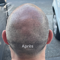 Photo n°7 de Pile poil 29 à Pont-l'Abbé (Clinique de maquillage permanent)