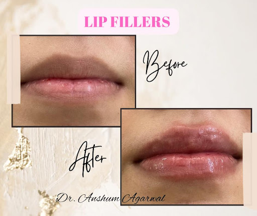 Looking for glowing, healthy skin? D.Aesthetix in Keshavpuram offers advanced skin treatments by…