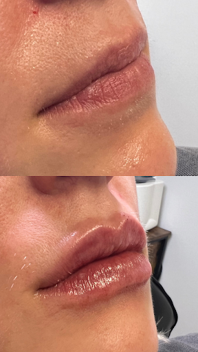 Top Deck Medical Aesthetics and Wellness - Billings