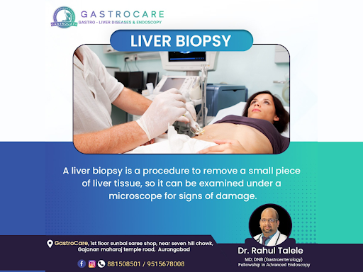 #drrahultalele #best gastroenterologist in aurangabad