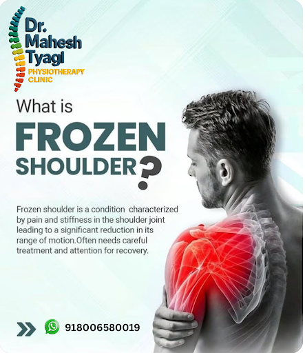 Dr Mahesh Tyagi Physiotherapy Clinic, your trusted clinic for advanced frozen shoulder treatment… post image