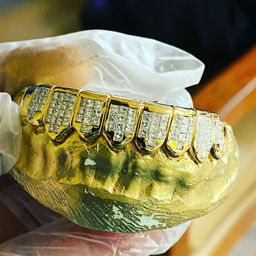 Gold 4 Ya Mouth