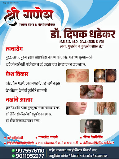 आपल्या त्वचा आणि नखांच्या सर्व समस्यांसाठी आता तज्ज्ञ उपचार उपलब्ध. post image