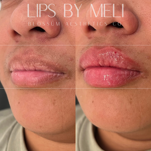 Blossüm Aesthetics Co. Med Spa