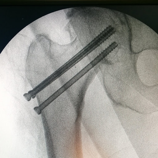 Dr Majed ISSA-Chirurgien orthopédiste-Sport et arthrose-Paris Lilas