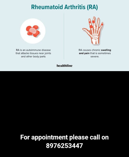 For Rheumatology consultation kindly visit Dr Halnor's Polaris multi-speciality clinic at Mirarao… post image