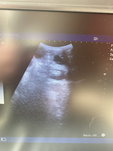 Animal Microchip Implantation and Pregnancy Ultrasound Scanning by Rachael
