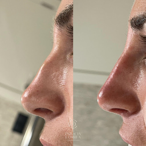 Dra Patricia Correa | Clínica de Medicina Estètica Gallery - Spain
