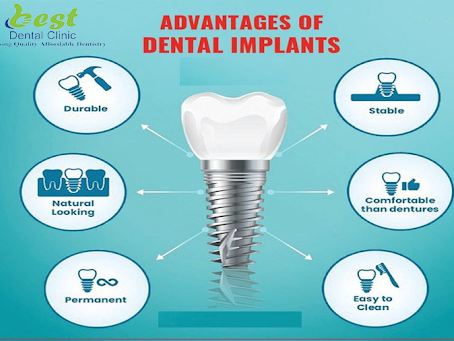 Dental implants are artificial tooth roots, which can be used to support fixed or removable repla… post image