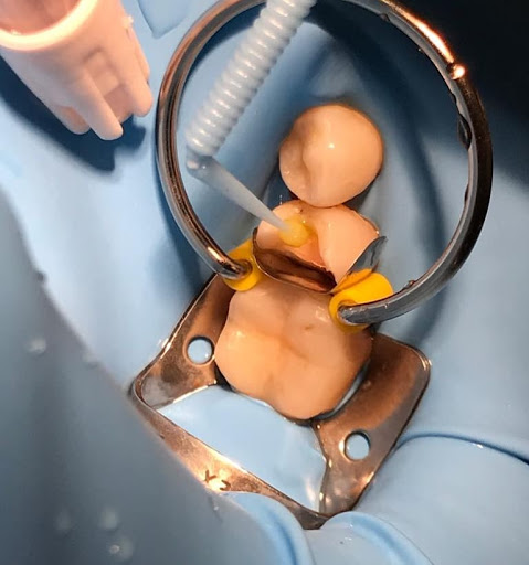 Consultorio Dental. Rehabilitación Oral. - Thumbnail