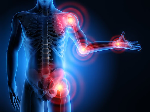 KLG Physio - Visual