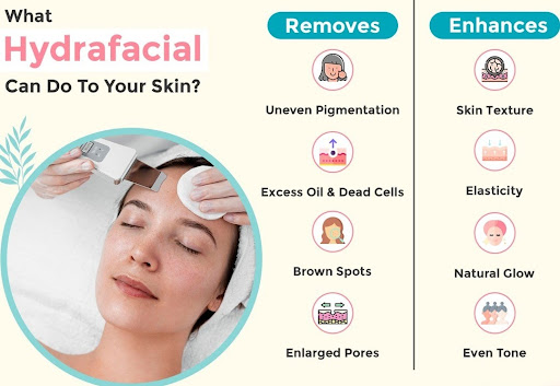 🤔 What Hydrafacial Can Do To Your Skin❓
