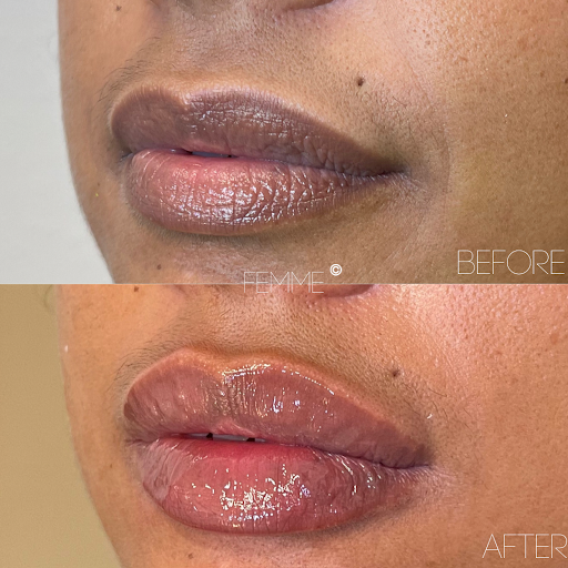 Femme Medspa