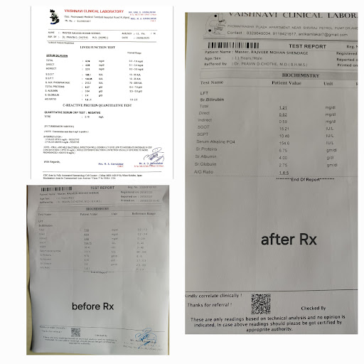 Hepatitis can be treated with homeopathy without allopathy and hospitalisation post image