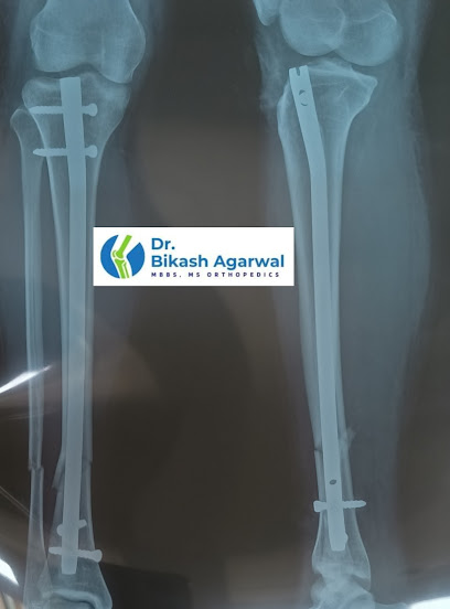 Dr. Bikash Agarwal MS Orthopaedics || Best Orthopedics and Sports Injury Doctor in Dhubri town