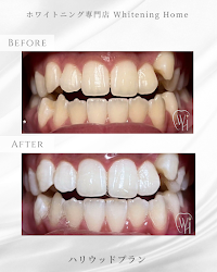 ホワイトニングホーム泉大津店