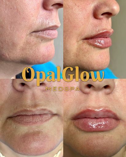 OpalGlow Medspa