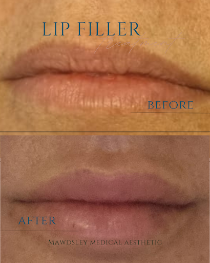 Aesthetic Care by Nurse Fallon