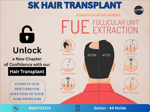 Are you looking for economical hair transplant services? SK Hair Transplant Clinic in Sector 44,…