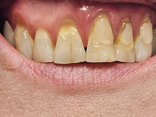 Donato A. Valente DDS, PC