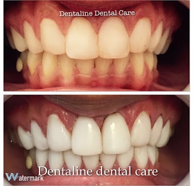 Dentaline Dental Care, Author: Dentaline Dental Care