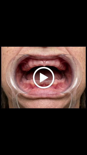 🦷 Wisdom Tooth Pain?  post image