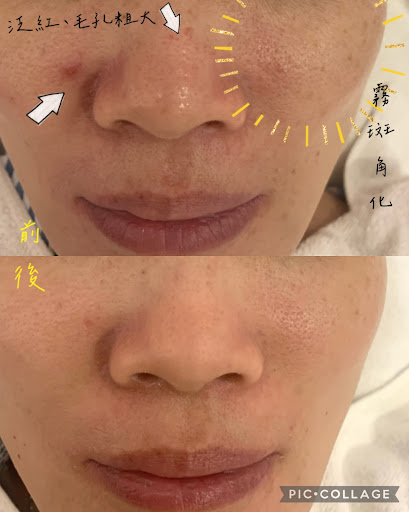 克麗緹娜評價、營業時間、服務項目、價格 - 專業肉芽清除與臉部保養