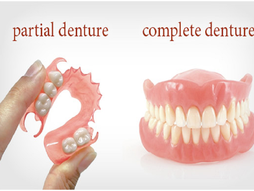 A typical procedure for placement of permanent dentures involves an oral examination of the patie…
