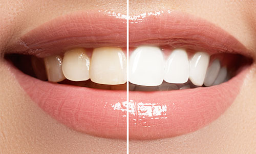 River North Dental Group Gallery - United States