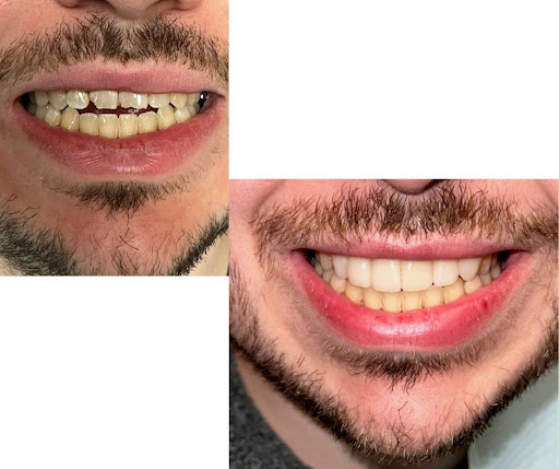 Hanna Dental Group Gallery - United States