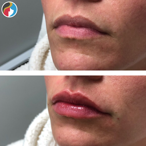 Rejuvn8 Aesthetics - Syracuse