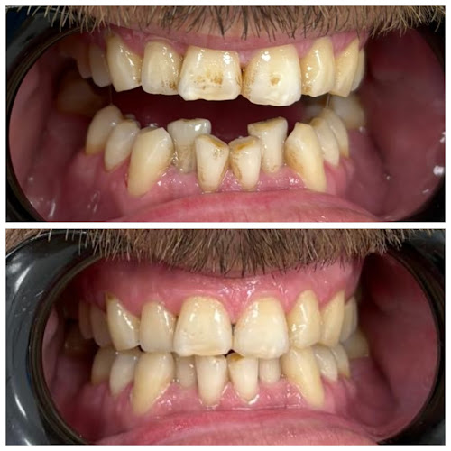 Dental centar Smile - Bjelovar