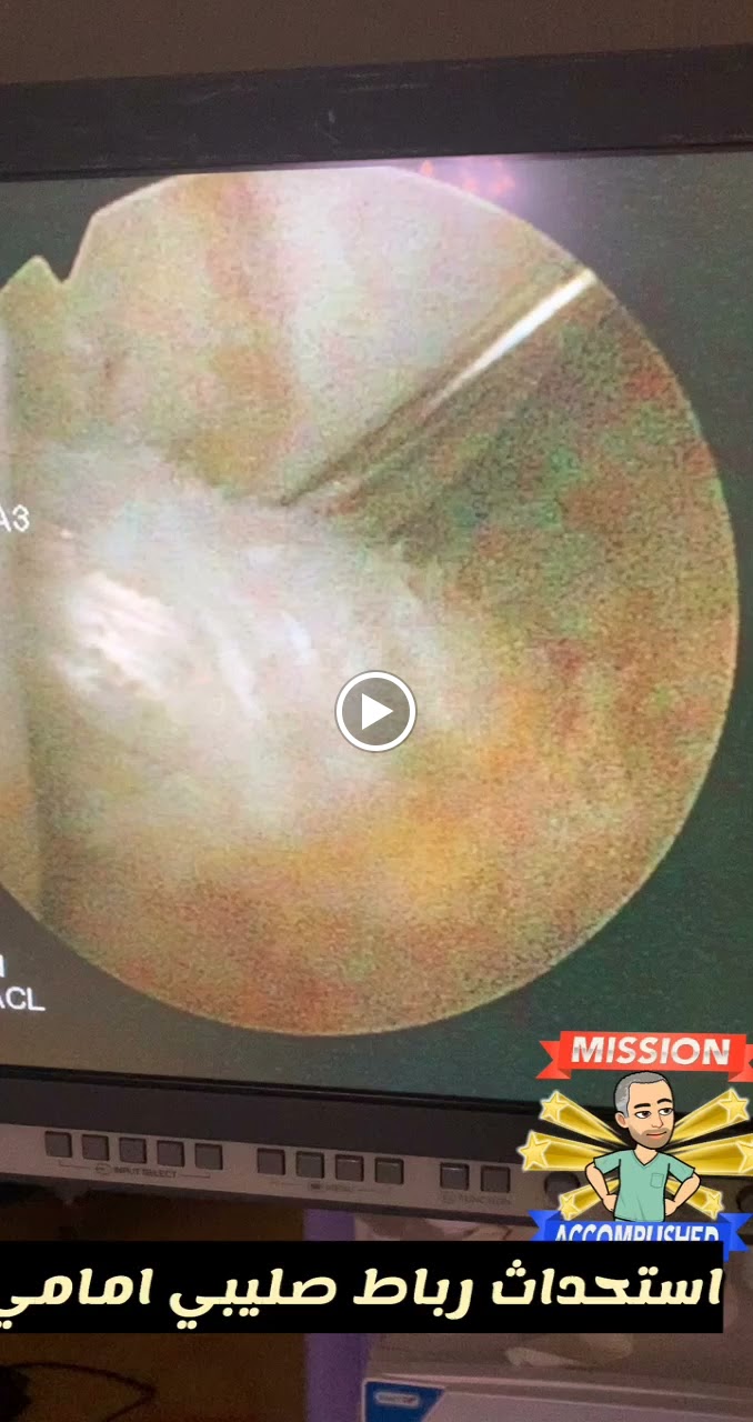 الدكتور محمد الكاف استشاري جراحة العظام و المفاصل والكسور - صورة 3