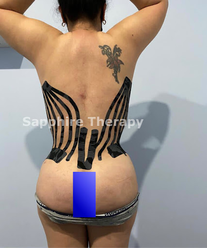 Sapphire After Lipo Therapy Miami: Lymphatic Drainage Center - Thumbnail