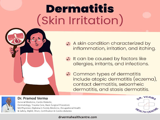 Dermatitis: A common skin irritation you need to know post image