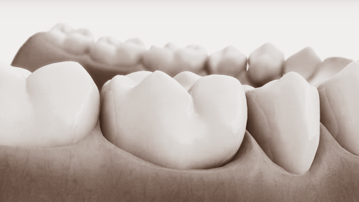 Aurodent. Dentista en San Miguel de Allende